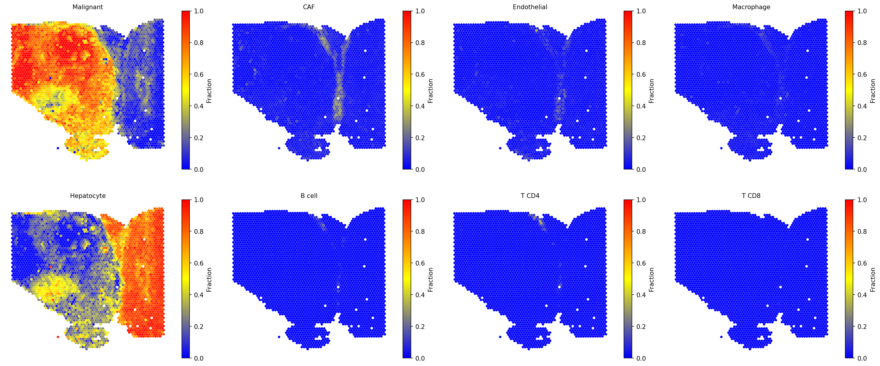 HCC cell type fractions