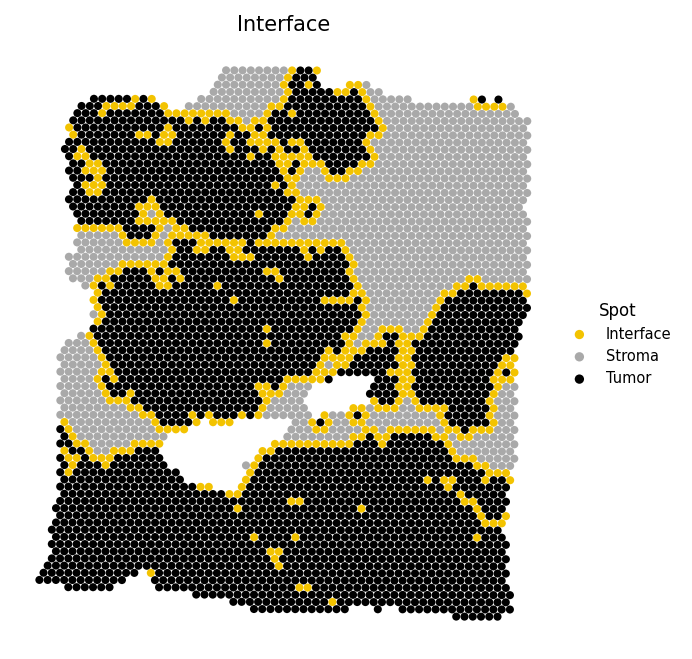 Tumor-stroma interface