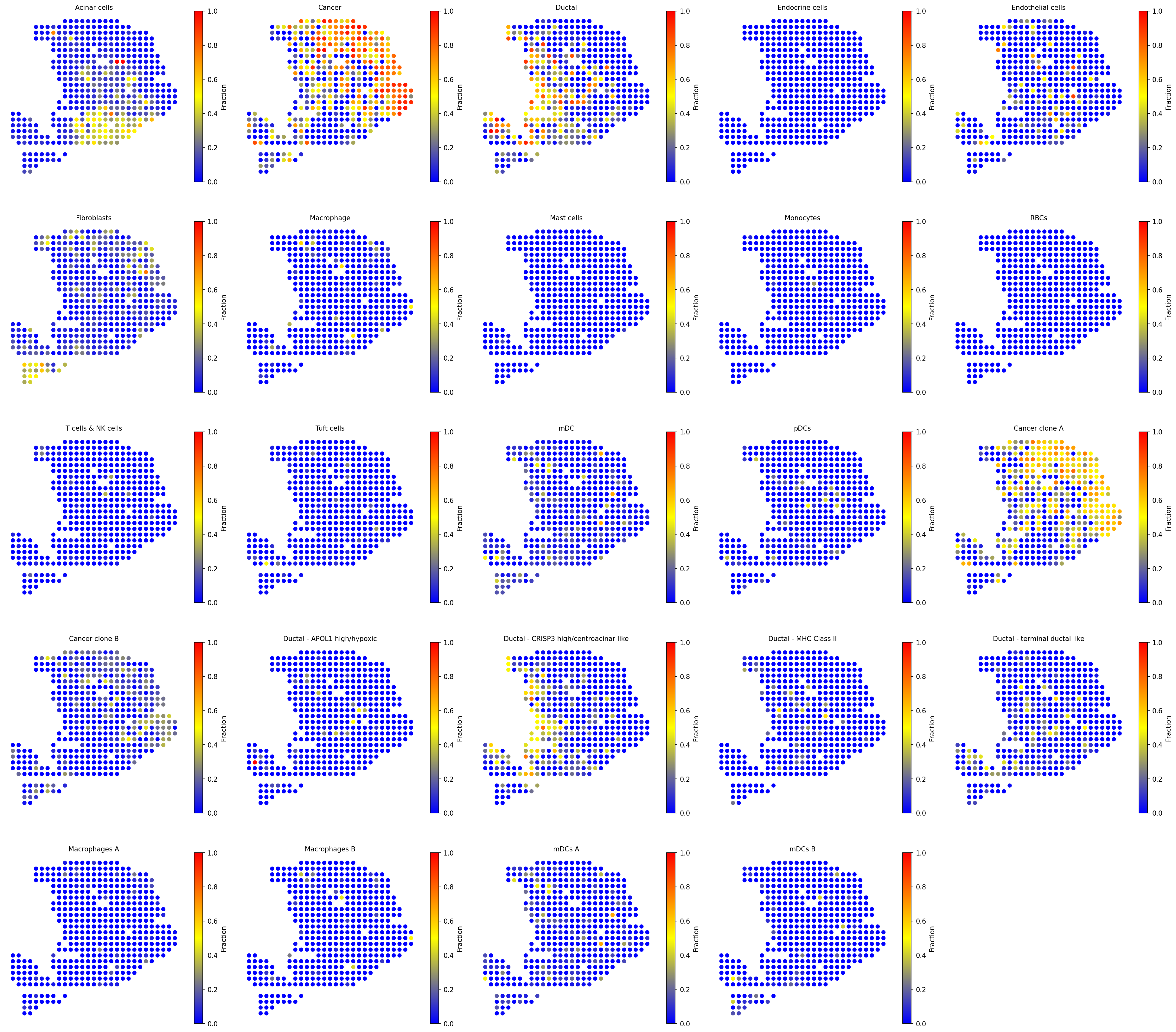 All cell type fractions in PDAC