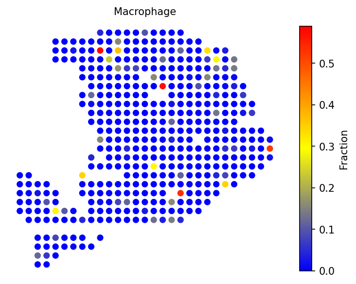 Specific cell type fractions in PDAC